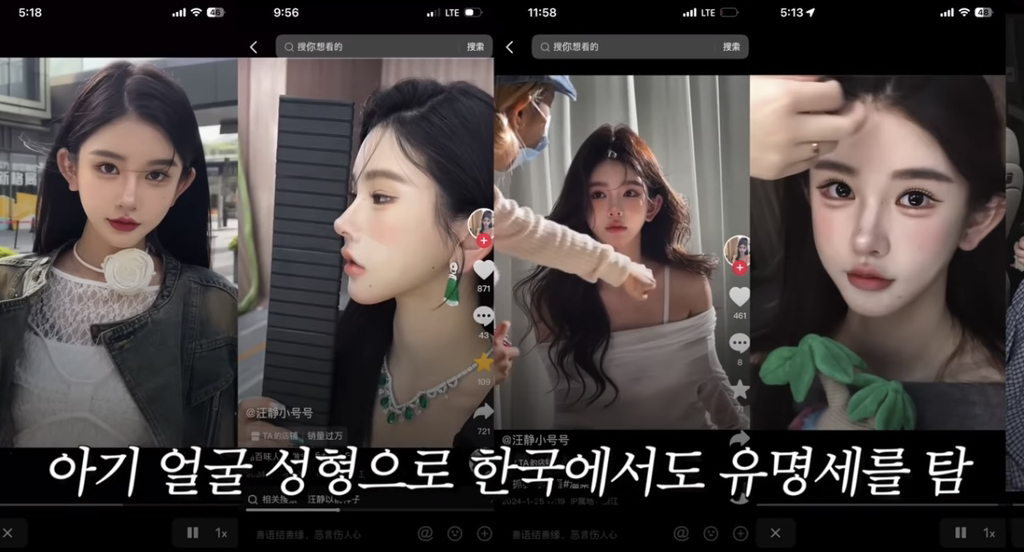 중녀 미감 만들어준다는 왕징 성형외과 다녀온 유튜버.jpg | 인스티즈