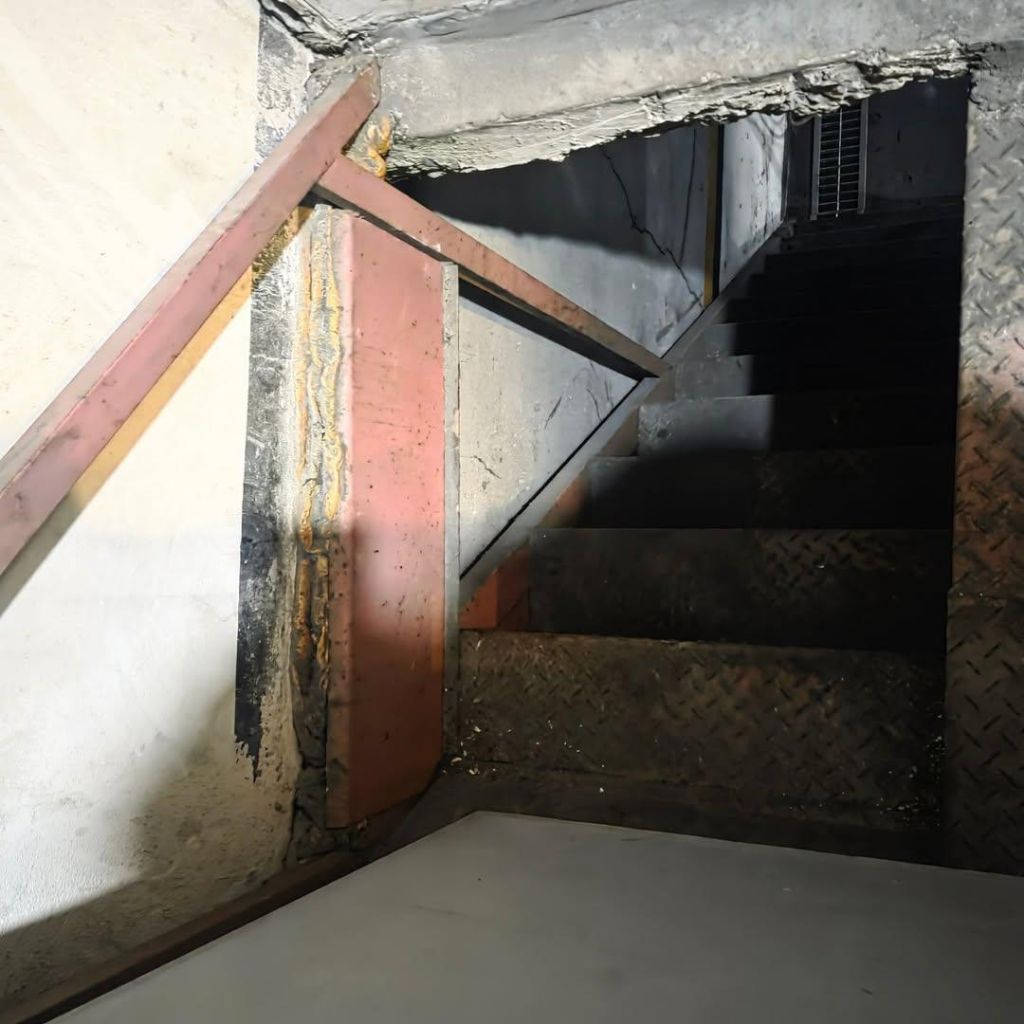 (상처 사진 주의) 노래방 계단에서 추락했는데 어떻게 고소해야함? | 인스티즈