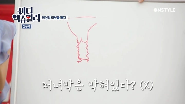 실제 처녀막 사진.jpg | 인스티즈