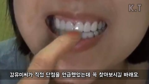 연예인들 라미네이트 전후 | 인스티즈