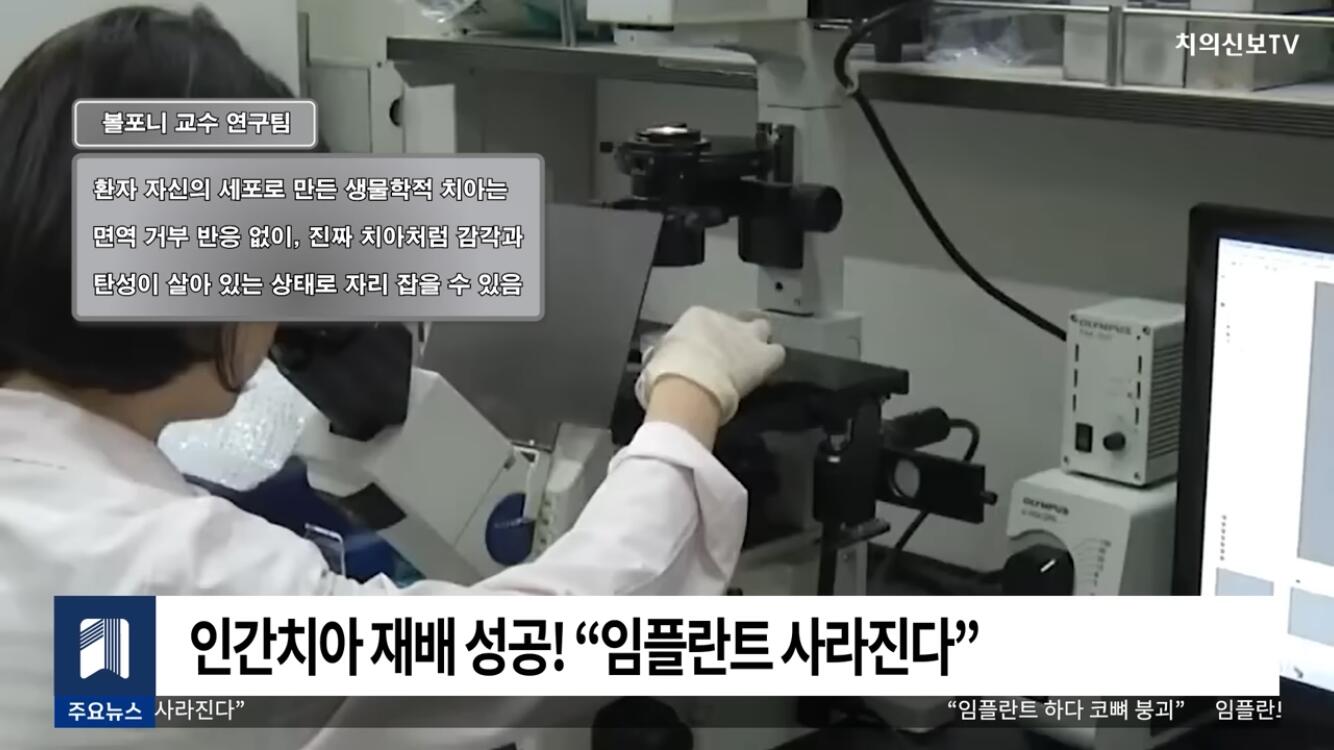 일본 인간 치아 재배 성공 | 인스티즈