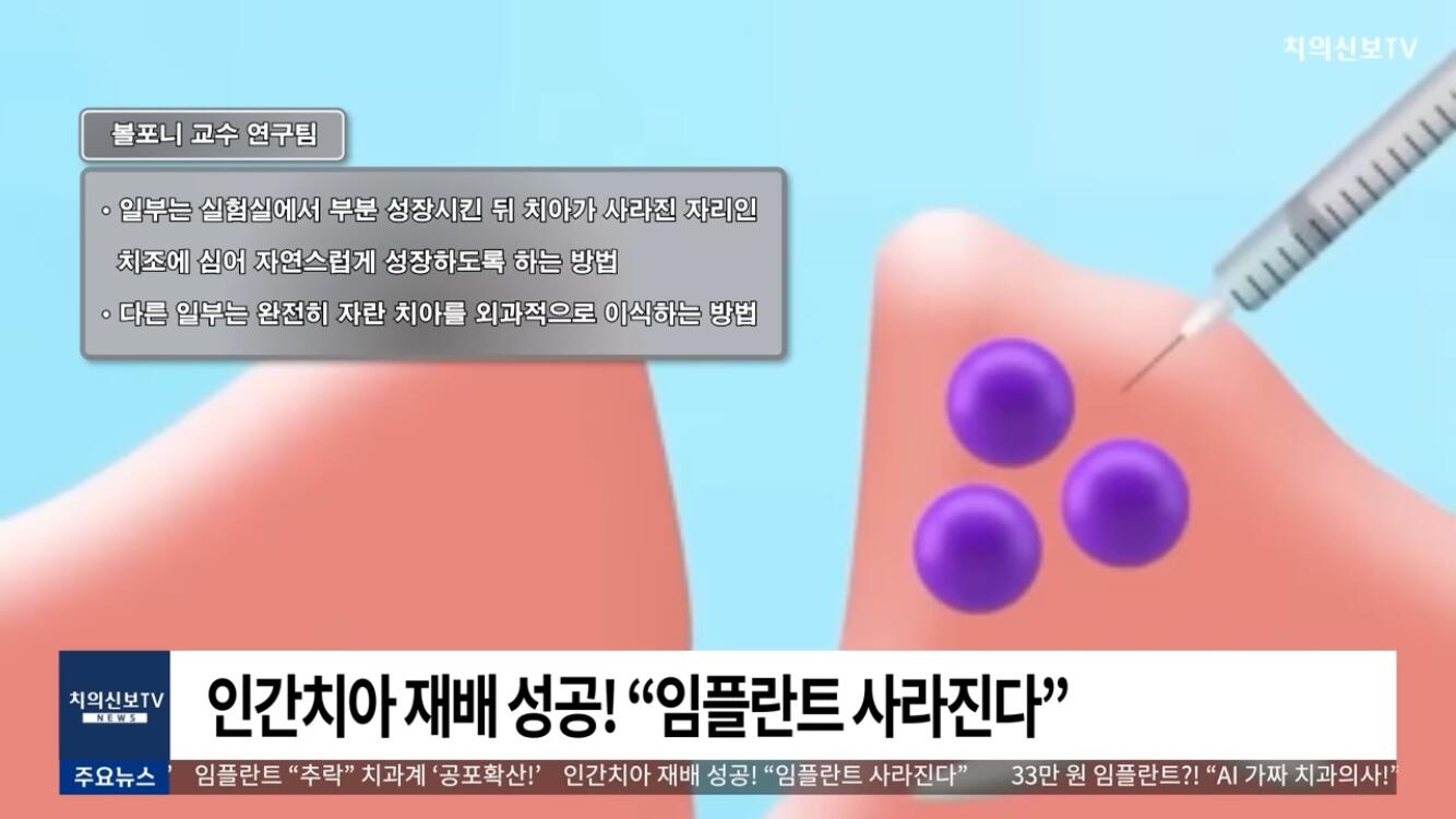 일본 인간 치아 재배 성공 | 인스티즈