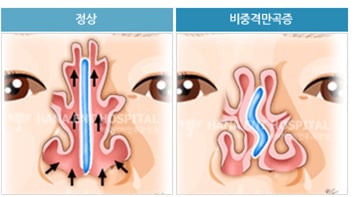 군대가면 많이 걸리는 병들 .jpg | 인스티즈