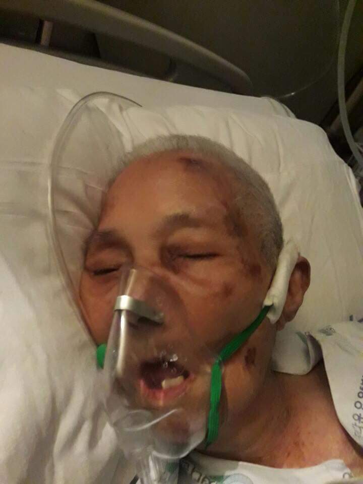 요양원에서 뇌출혈로 돌아가신 할머니 (진실을 밝힐수 있게 여러분이 도와주세요) | 인스티즈