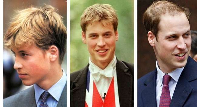 일본반응) 왜 갑자기 늙어버렸어?라고 생각하는 유명인 | 인스티즈