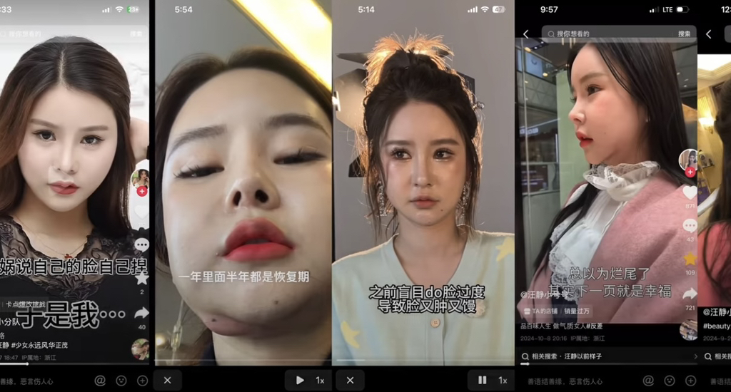 중녀 미감 만들어준다는 왕징 성형외과 다녀온 유튜버.jpg | 인스티즈