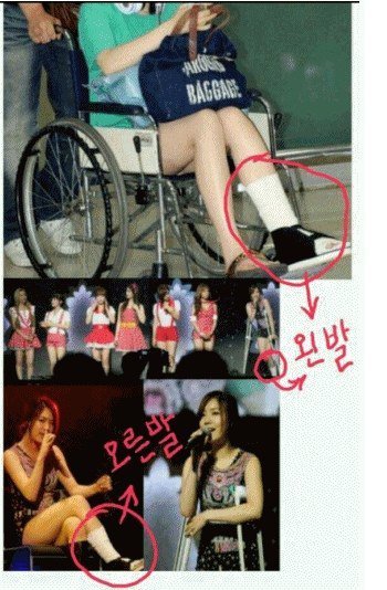 티아라 스탭글이 주작인 이유 | 인스티즈