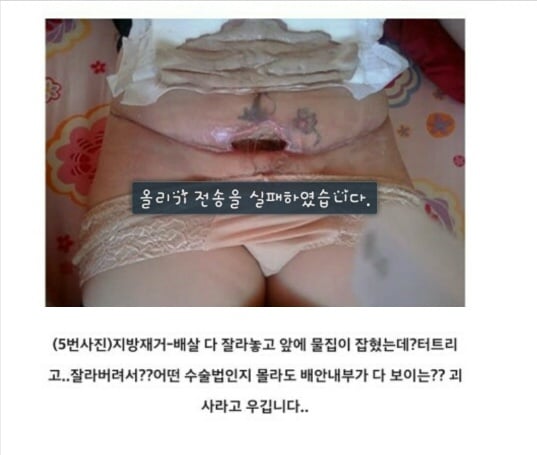 아래 글 사이코패스의사 성형 피해자들 사진 (심약자 주의!) | 인스티즈