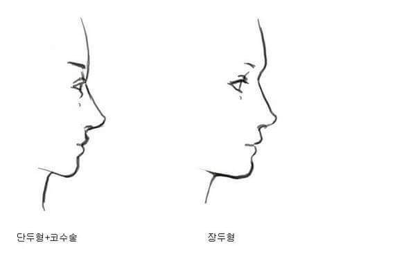 장두형vs단두형 | 인스티즈