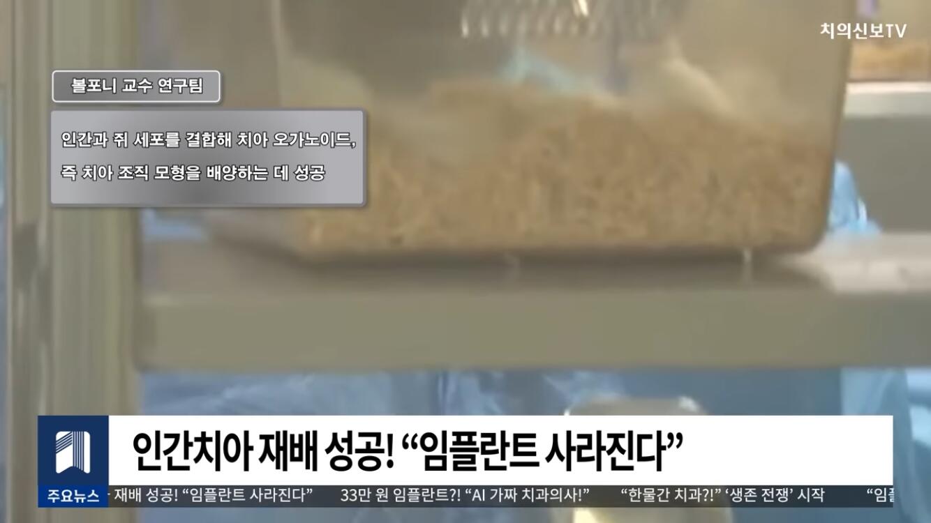 일본 인간 치아 재배 성공 | 인스티즈