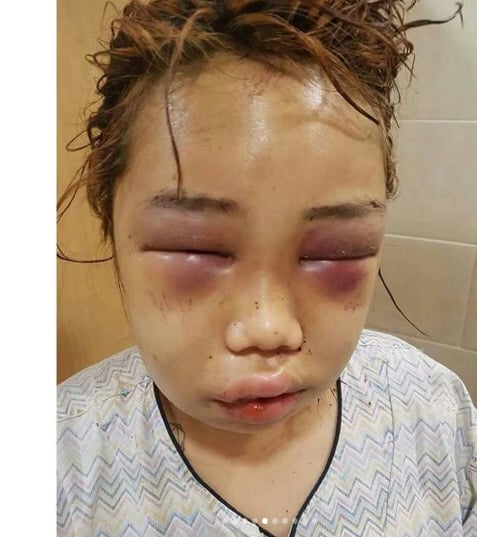 부산 여중생 집단 폭행사건 정리.jpg (사진주의) | 인스티즈
