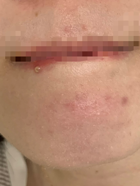 올리브영 세일 맞이 여드름 박사가 갈기는 지성 기초 루틴!! | 인스티즈