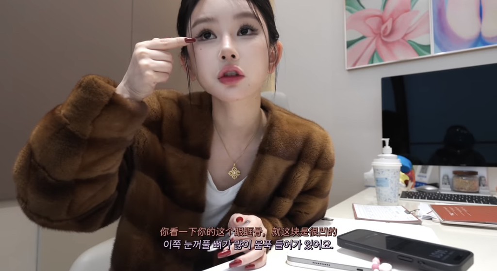 중녀 미감 만들어준다는 왕징 성형외과 다녀온 유튜버.jpg | 인스티즈