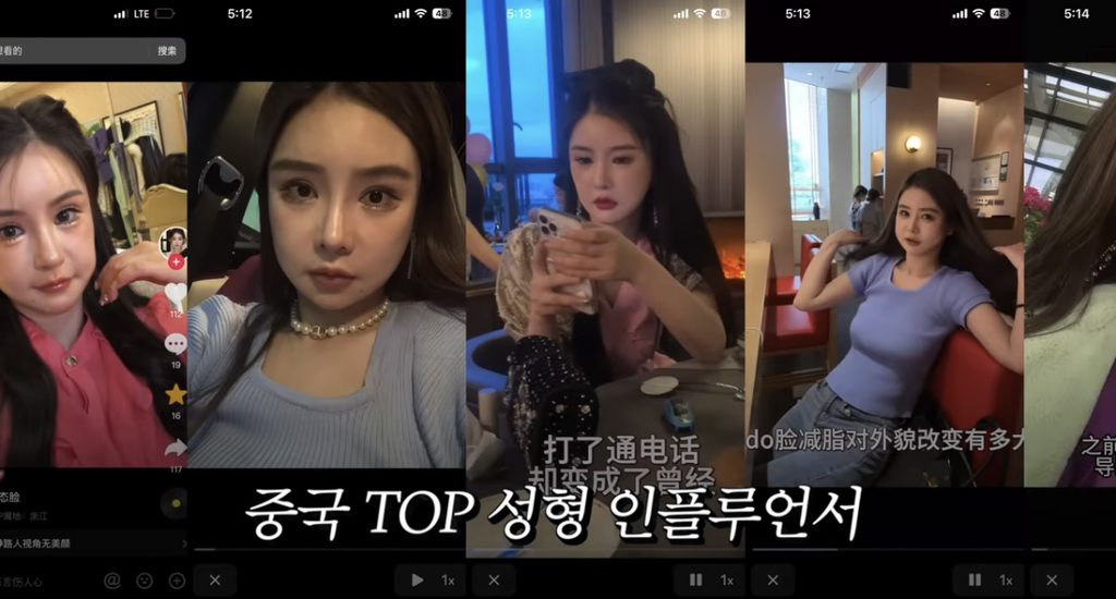 중녀 미감 만들어준다는 왕징 성형외과 다녀온 유튜버.jpg | 인스티즈