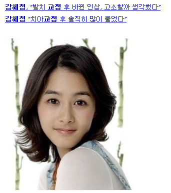 치아교정을 쉽게 생각해선 안되는 이유 (외모 변화) | 인스티즈