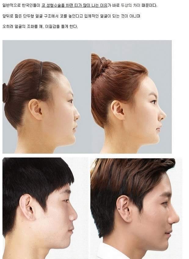 장두형vs단두형 | 인스티즈