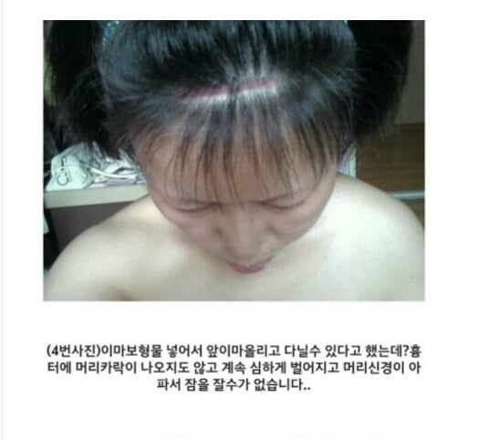 아래 글 사이코패스의사 성형 피해자들 사진 (심약자 주의!) | 인스티즈