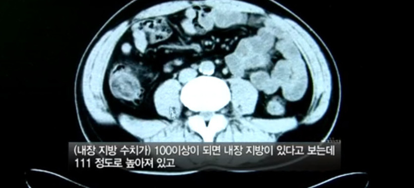 야간 근무 10년차인 43살 남성의 몸 상태 | 인스티즈