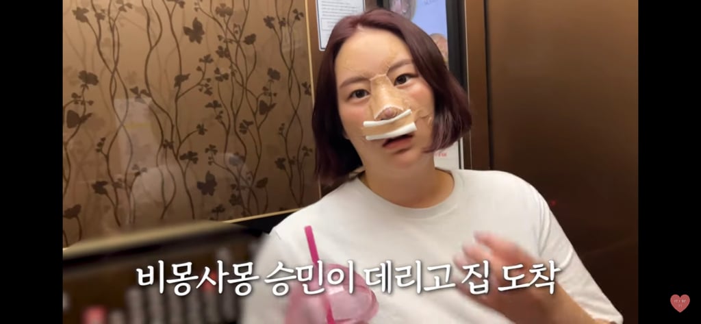유혜주 유튜브에 등장한 코성형 브이로그 | 인스티즈