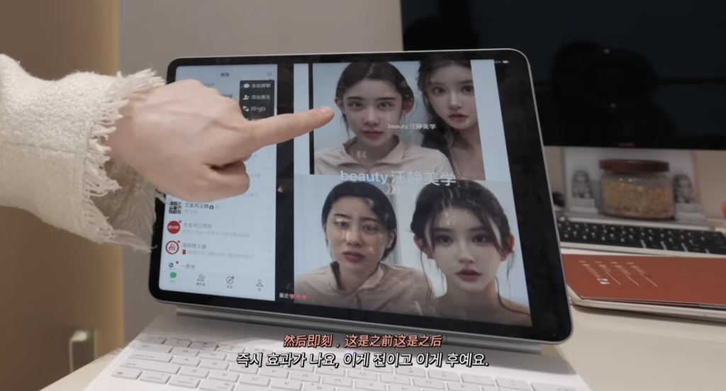 중녀 미감 만들어준다는 왕징 성형외과 다녀온 유튜버.jpg | 인스티즈