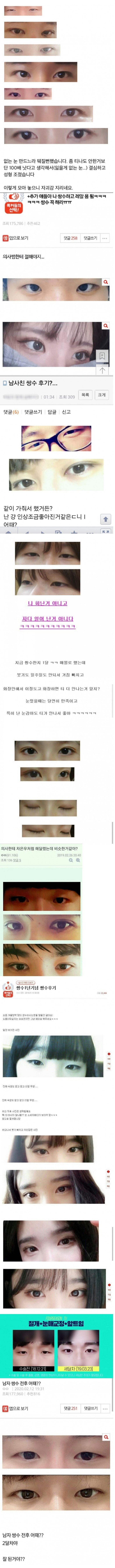 남녀 쌍수 레전드 후기들 | 인스티즈