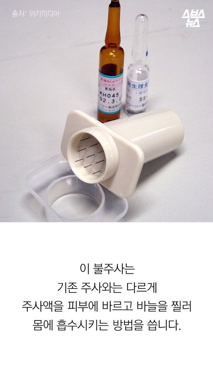 진짜 애기들한테서만 볼 수 있는 불주사자국...jpg | 인스티즈