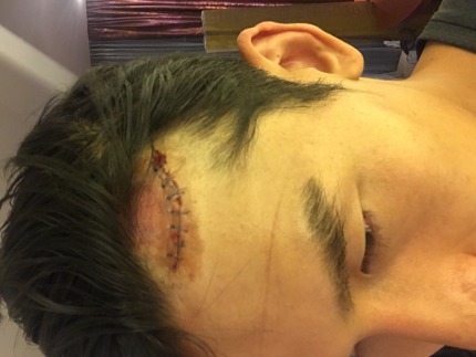 이ㅛ 선수 이마 ㅠ | 인스티즈