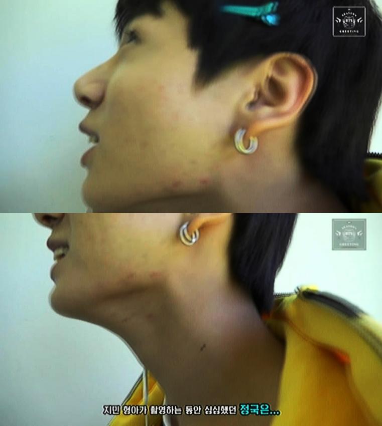 연예인들의 현실적인 피부.jpg | 인스티즈