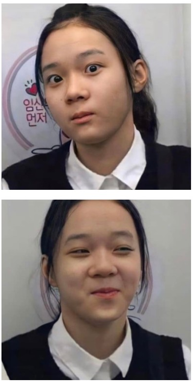 얼굴에서 코가 미적 분위기를 차지하는 정도 | 인스티즈