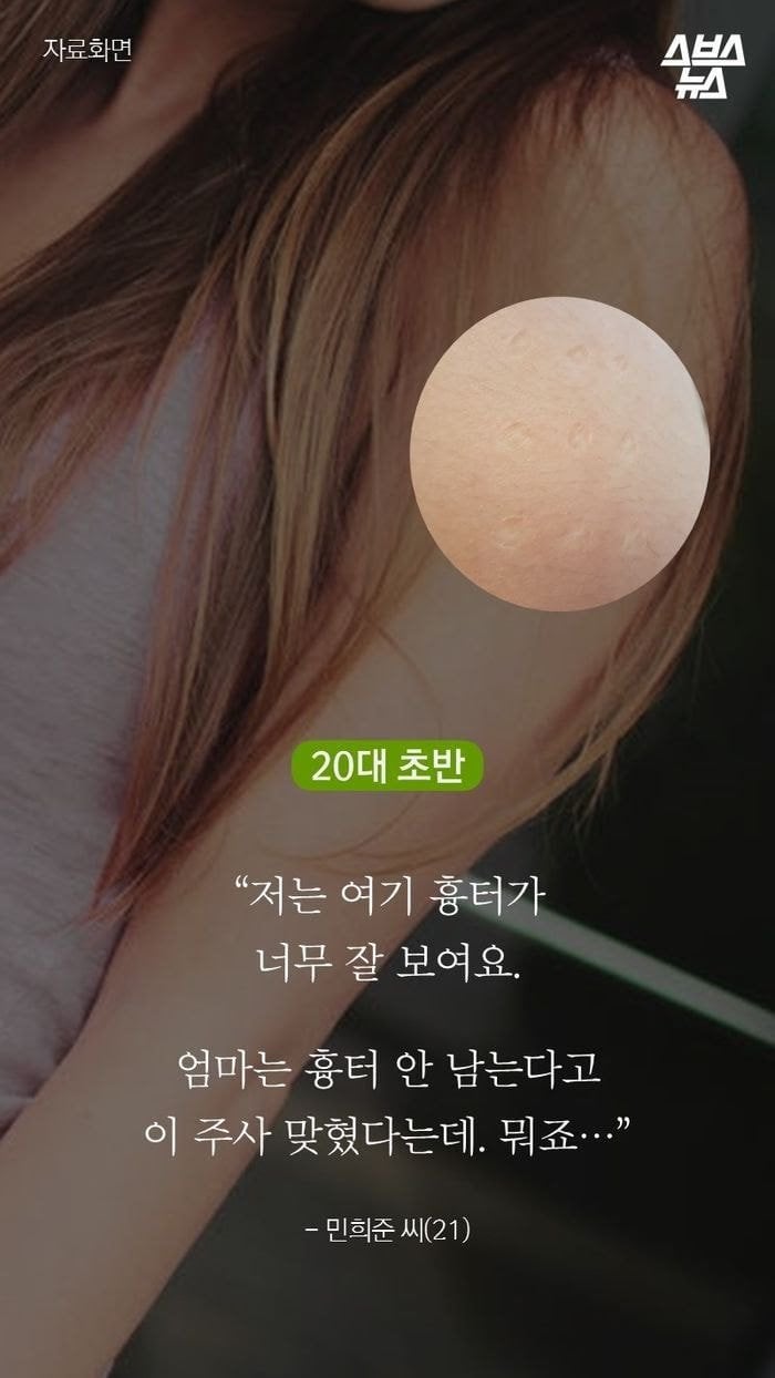 진짜 애기들한테서만 볼 수 있는 불주사자국...jpg | 인스티즈