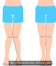 발레에서는 무조건 요정비율인게 중요한것인가? 발레신체에 대한 글!(쓸모없음주의) | 인스티즈