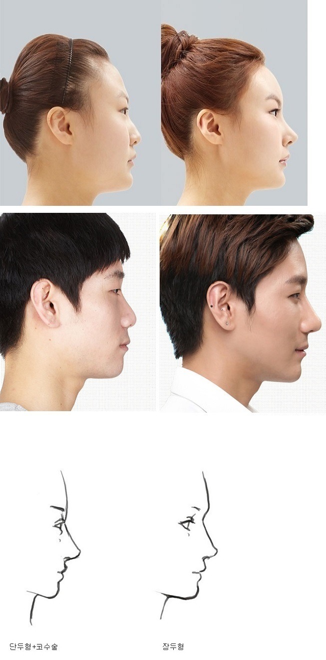 장두형 단두형에 대해서 알아보자 jpg | 인스티즈