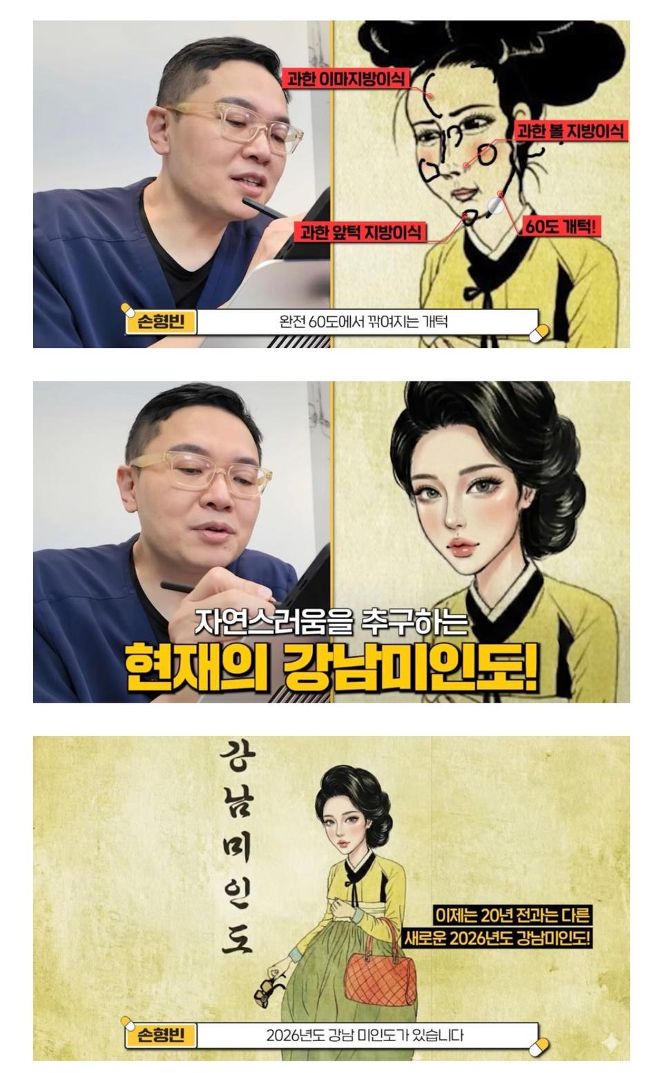 2026년 성형 트렌드 | 인스티즈