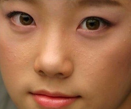 연예인들의 현실적인 피부.jpg | 인스티즈