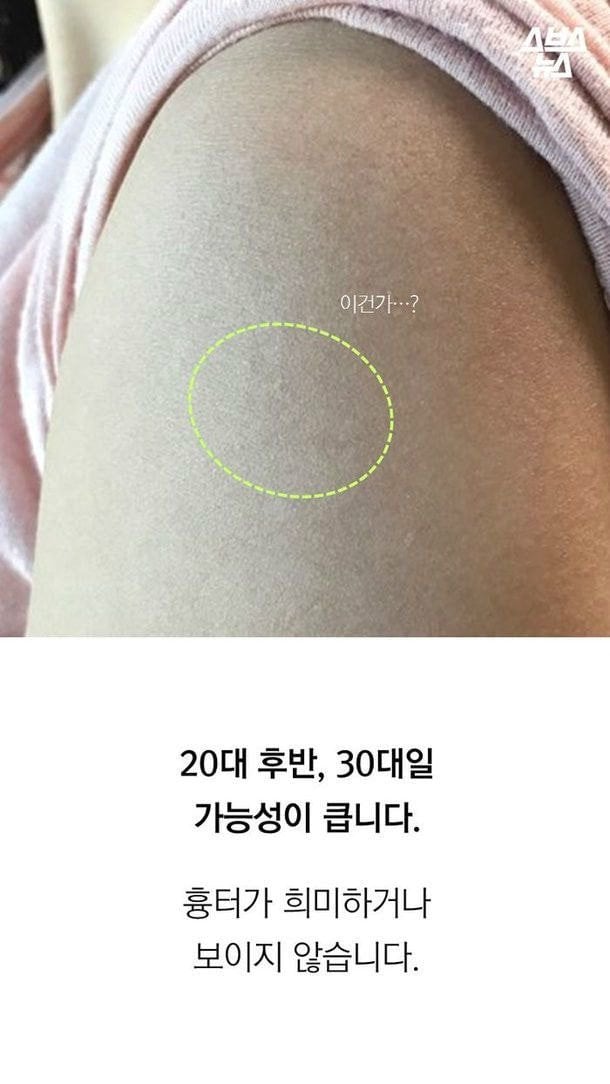 진짜 애기들한테서만 볼 수 있는 불주사자국...jpg | 인스티즈