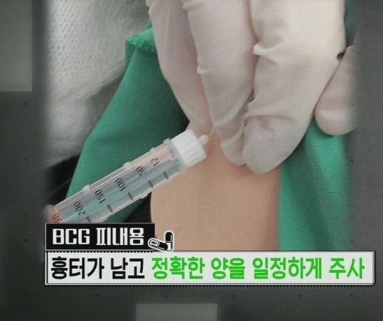 진짜 애기들한테서만 볼 수 있는 불주사자국...jpg | 인스티즈