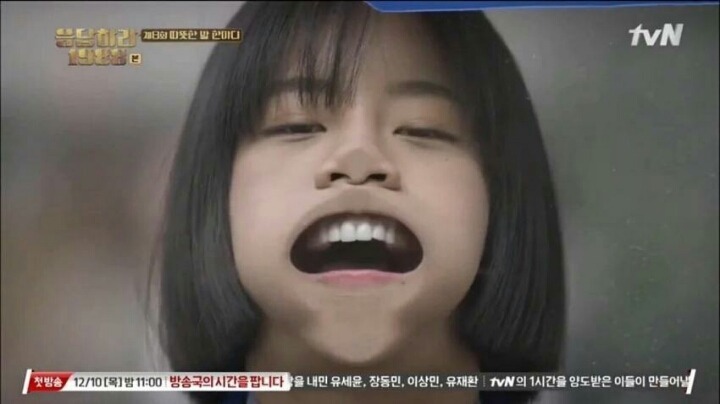 코 성형 안한 혜리.gif | 인스티즈