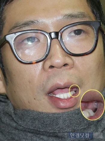 이쯤에서 다시 보는 MC몽 치아 상태.jpg | 인스티즈
