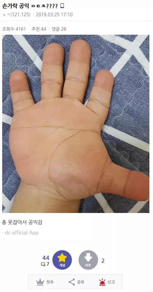손가락 때문에 4급 판정 받은 공익.jpg | 인스티즈