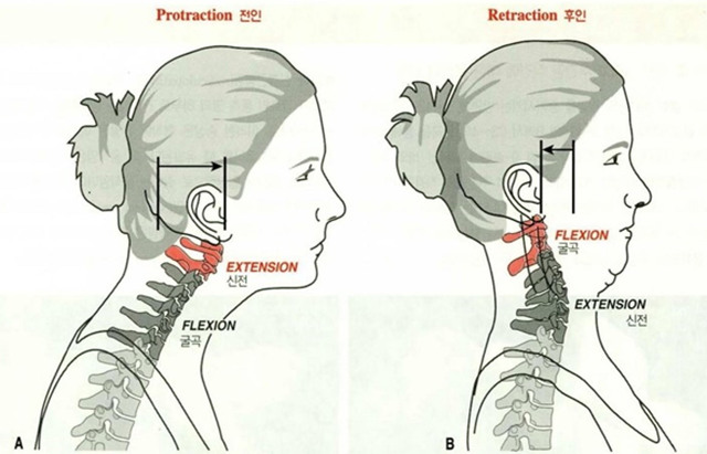 거북목을 고쳐봅시다 - 2탄 (0. 거북목과 이중턱 1.턱 운동에 대해 2.턱운동 해보기) - 데이터 스압주의 | 인스티즈
