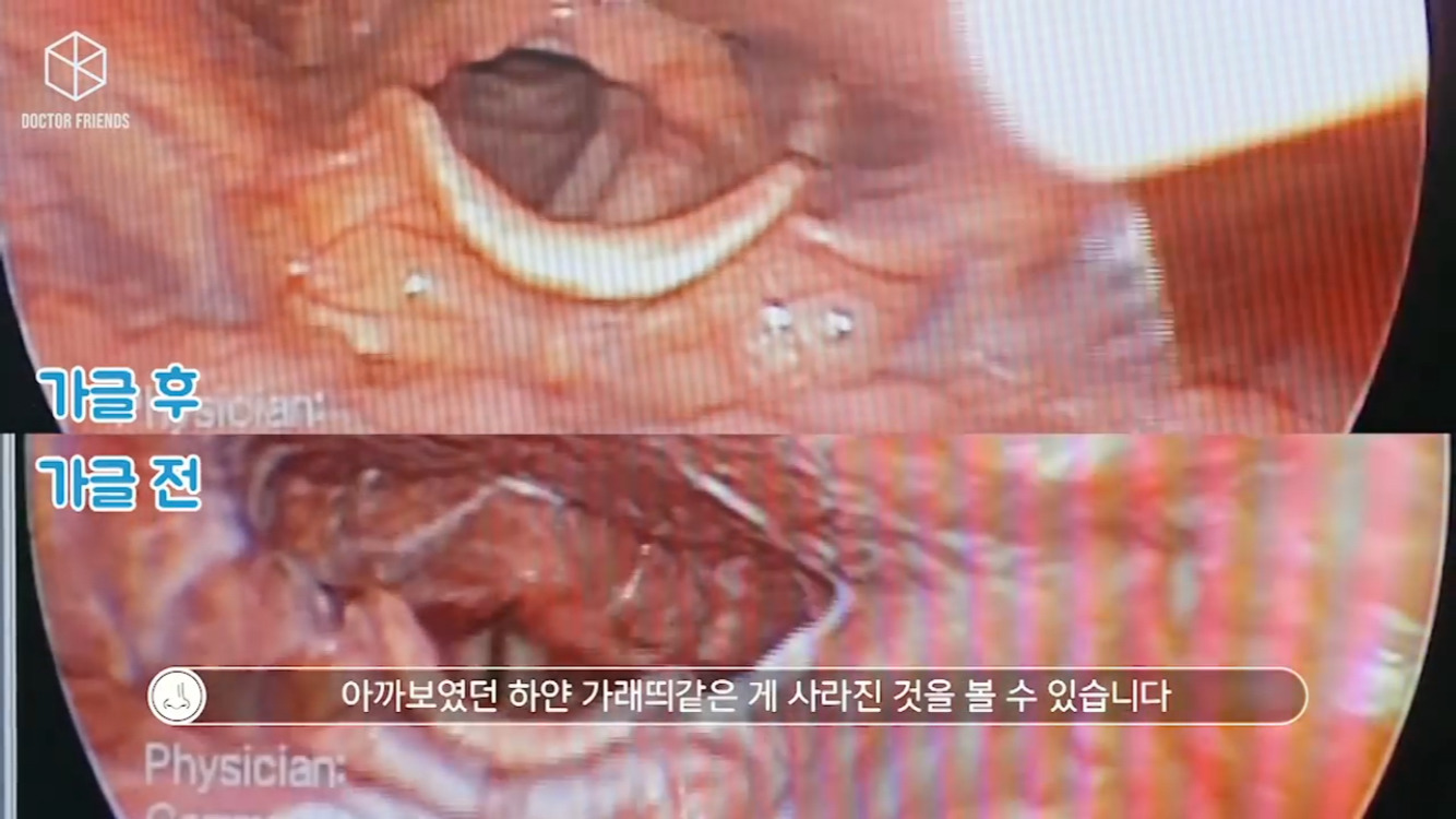 양치하고 아르르안하는 여시 들어와 | 인스티즈