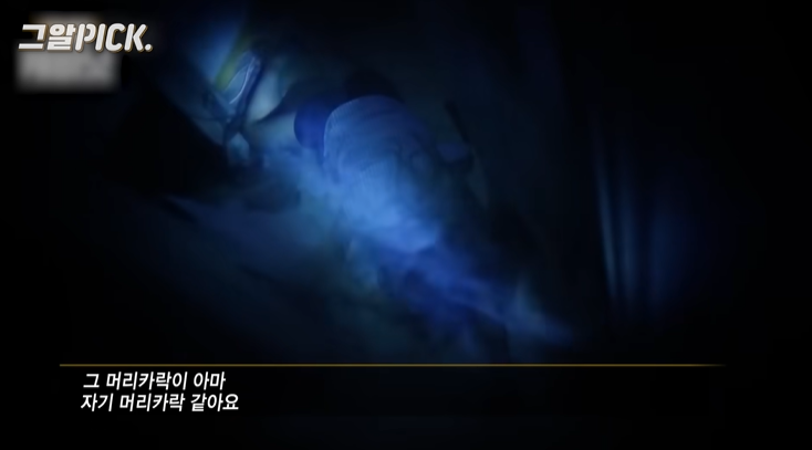 죽기전에 고통스러워서 자기 머리를 뜯은거에요 | 인스티즈