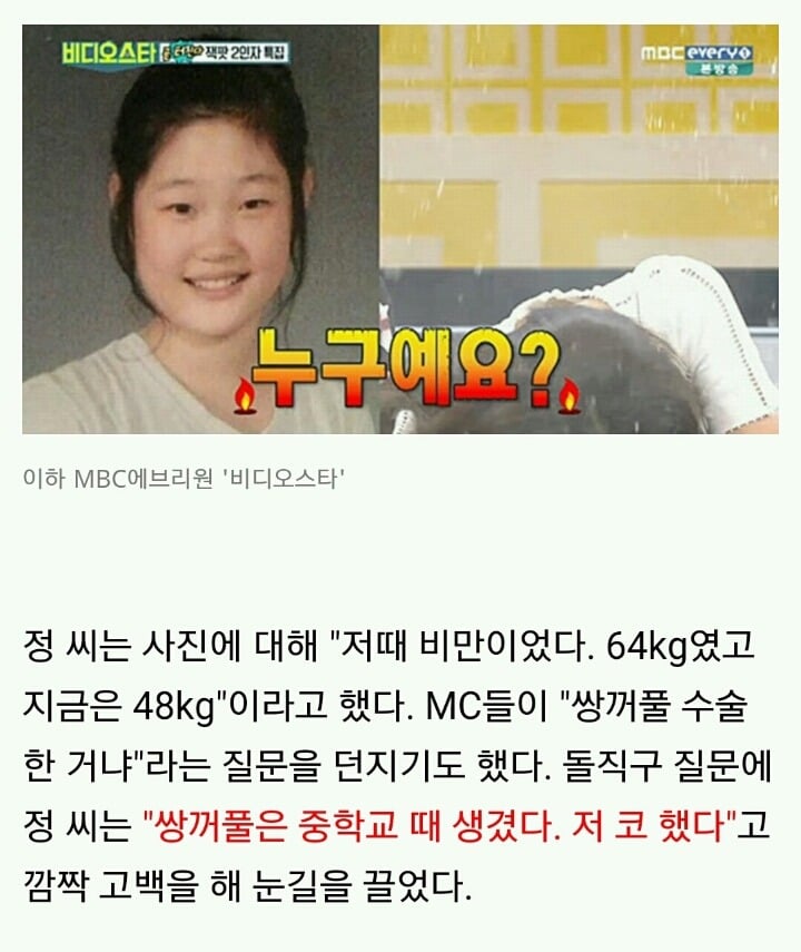 [정채연] 코 수술 했다고 밝힌 I.O.I 정채연 .jpg | 인스티즈