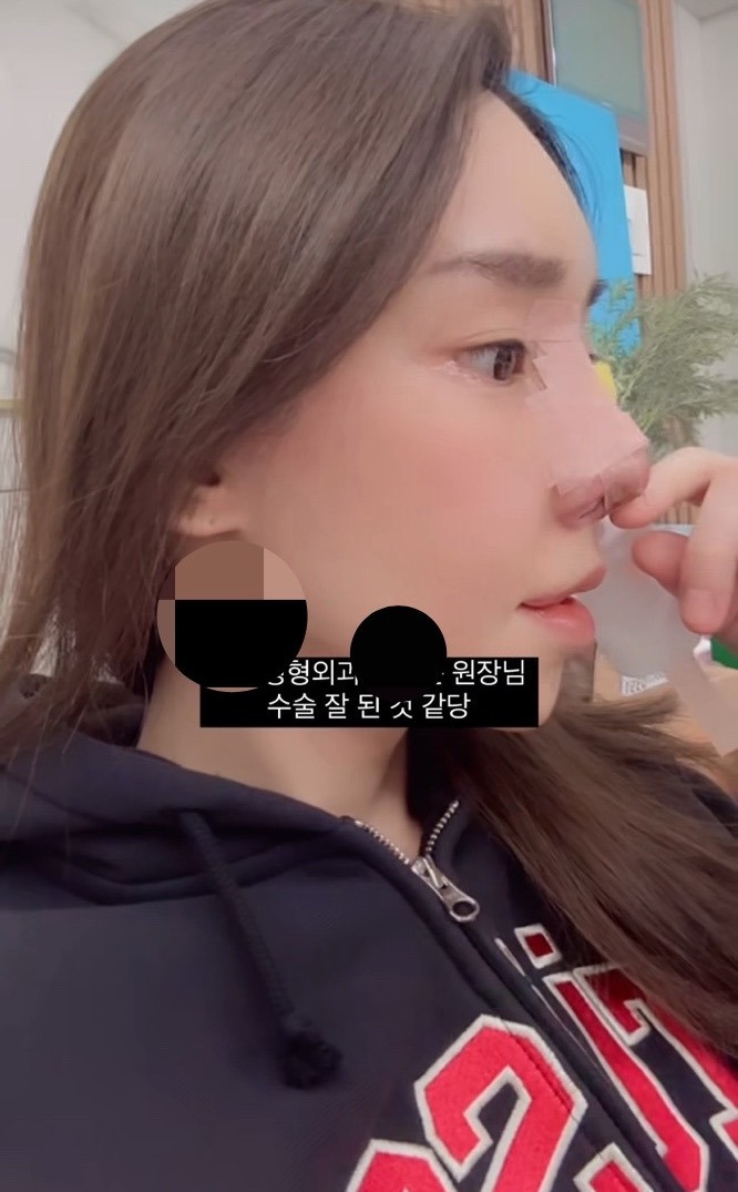 최근 15번째 코 수술을 마친 트랜스젠더 꽃자 | 인스티즈