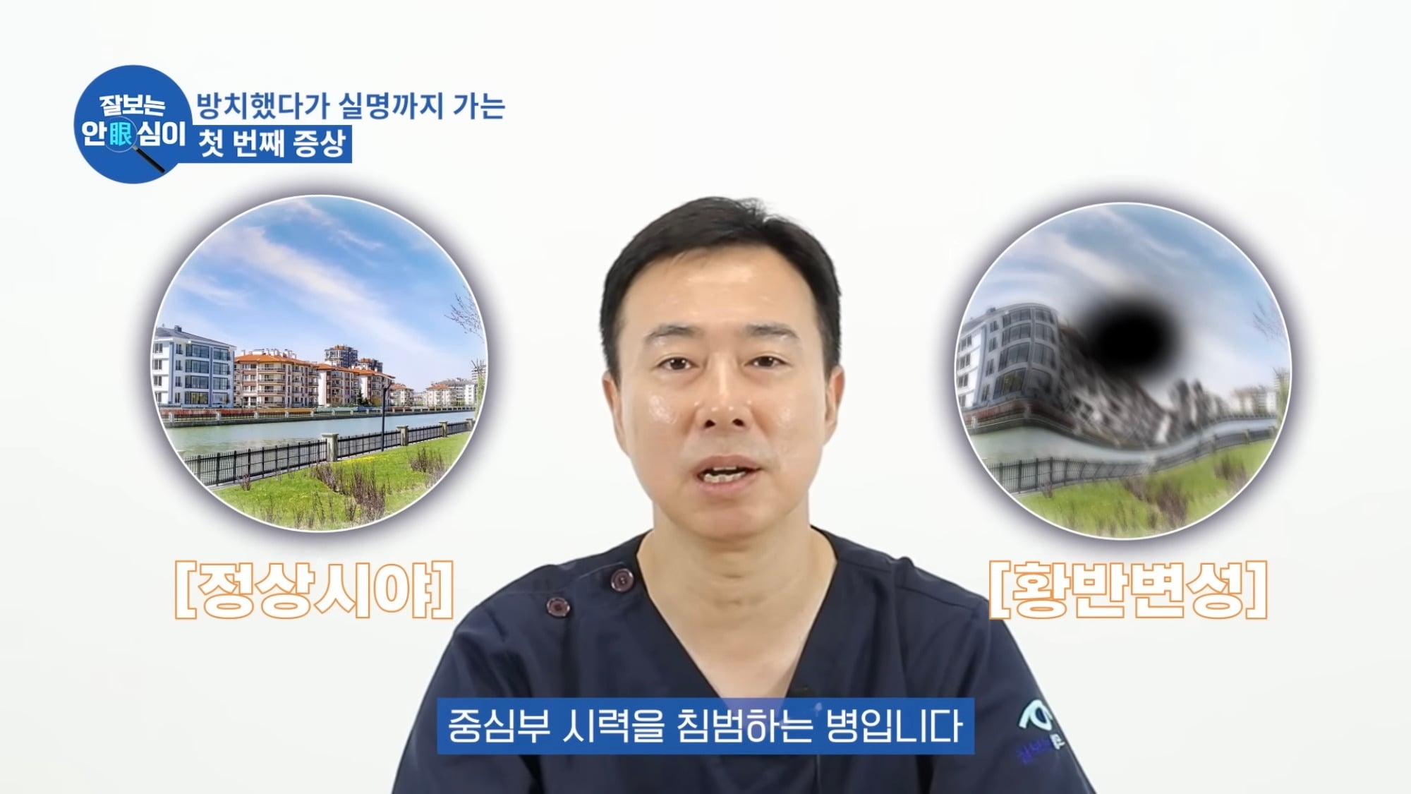 눈이 실명 전 잠깐 보내는 마지막 신호. 이 증상이 보인다면 당장 병원 뛰쳐가세요.jpg | 인스티즈