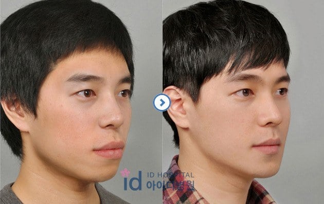 남자가 하관만 달라져도.jpg | 인스티즈