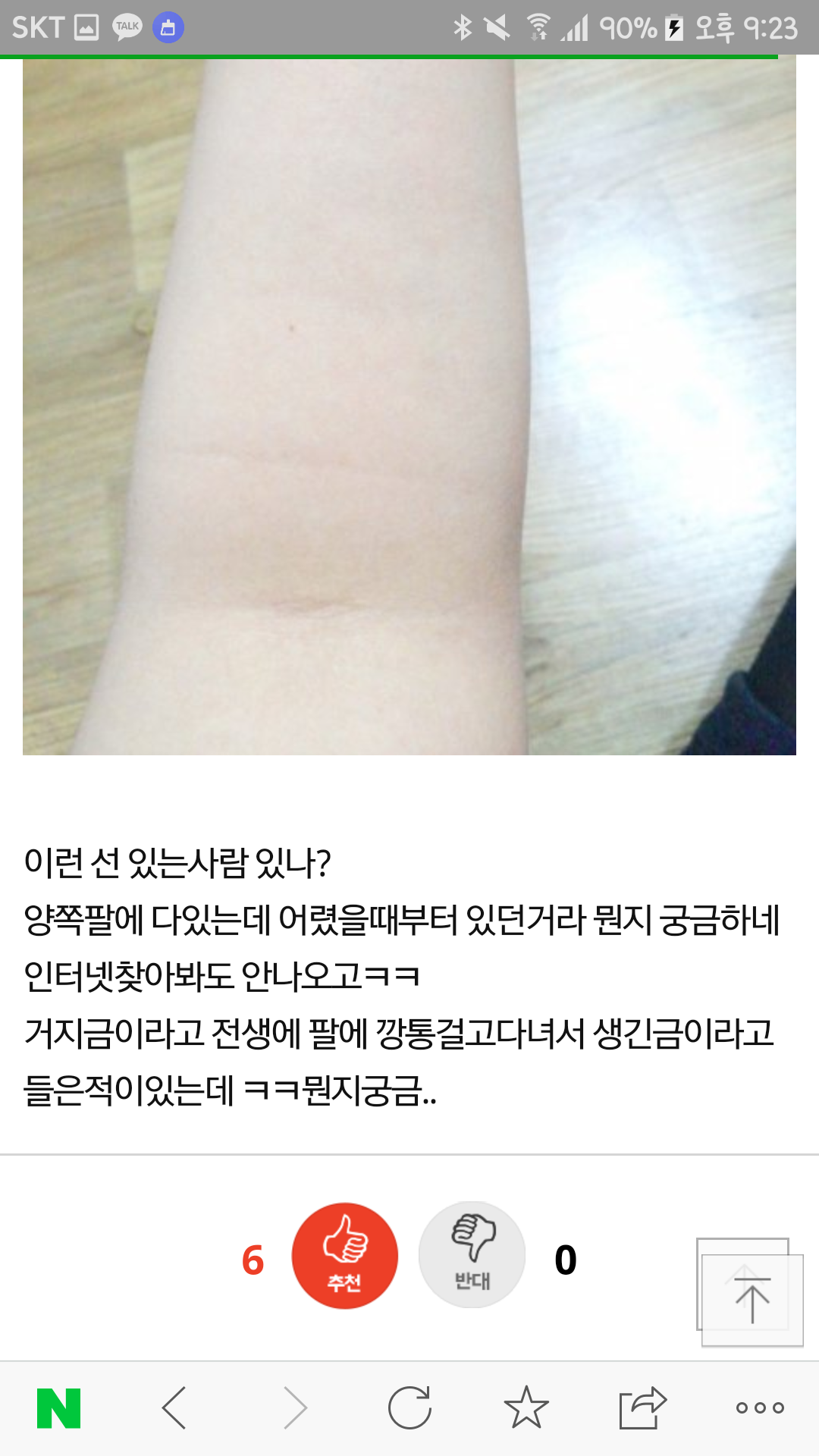 팔 안 쪽에 있는 주름 : 거지선 | 인스티즈