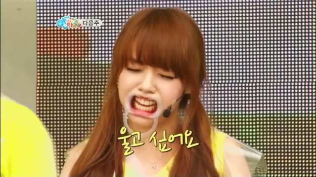 개구기 장착한 연예인들 | 인스티즈
