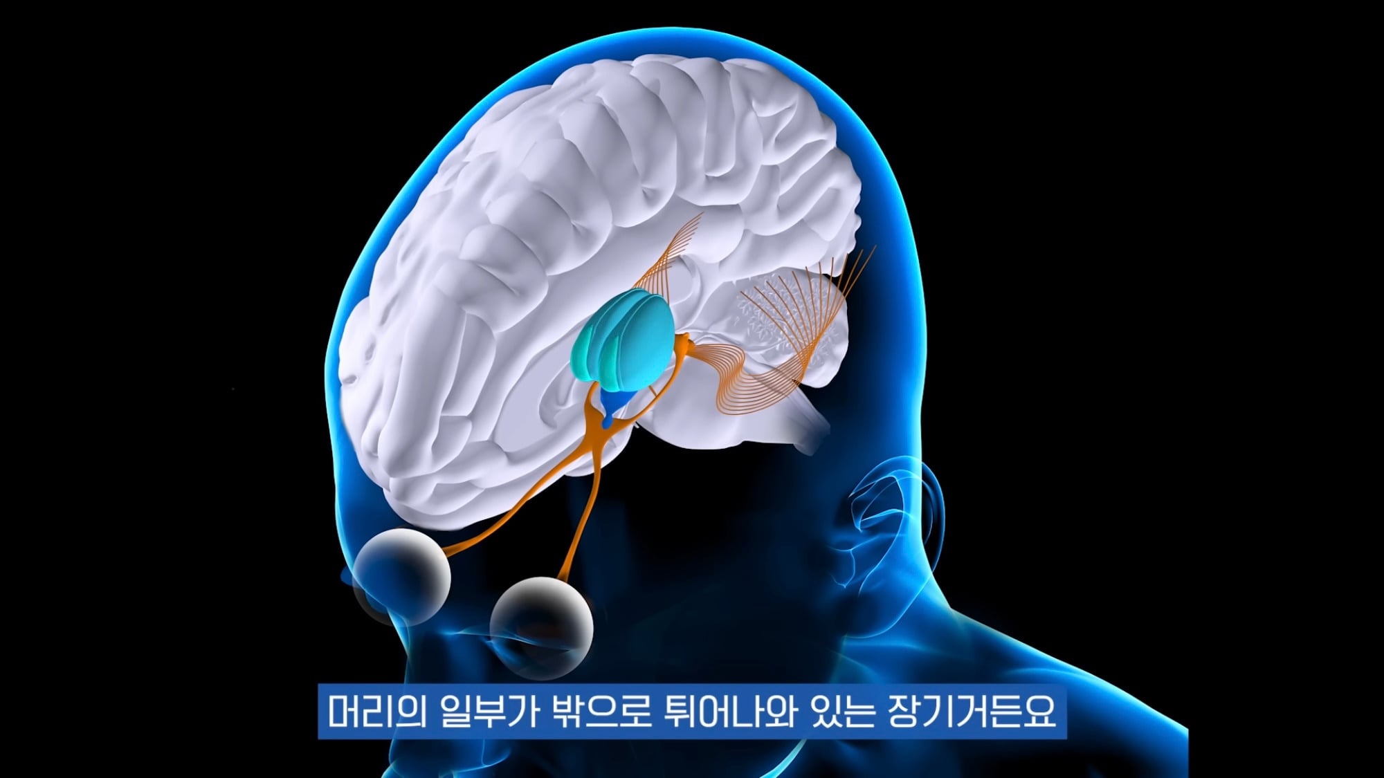 눈이 실명 전 잠깐 보내는 마지막 신호. 이 증상이 보인다면 당장 병원 뛰쳐가세요.jpg | 인스티즈