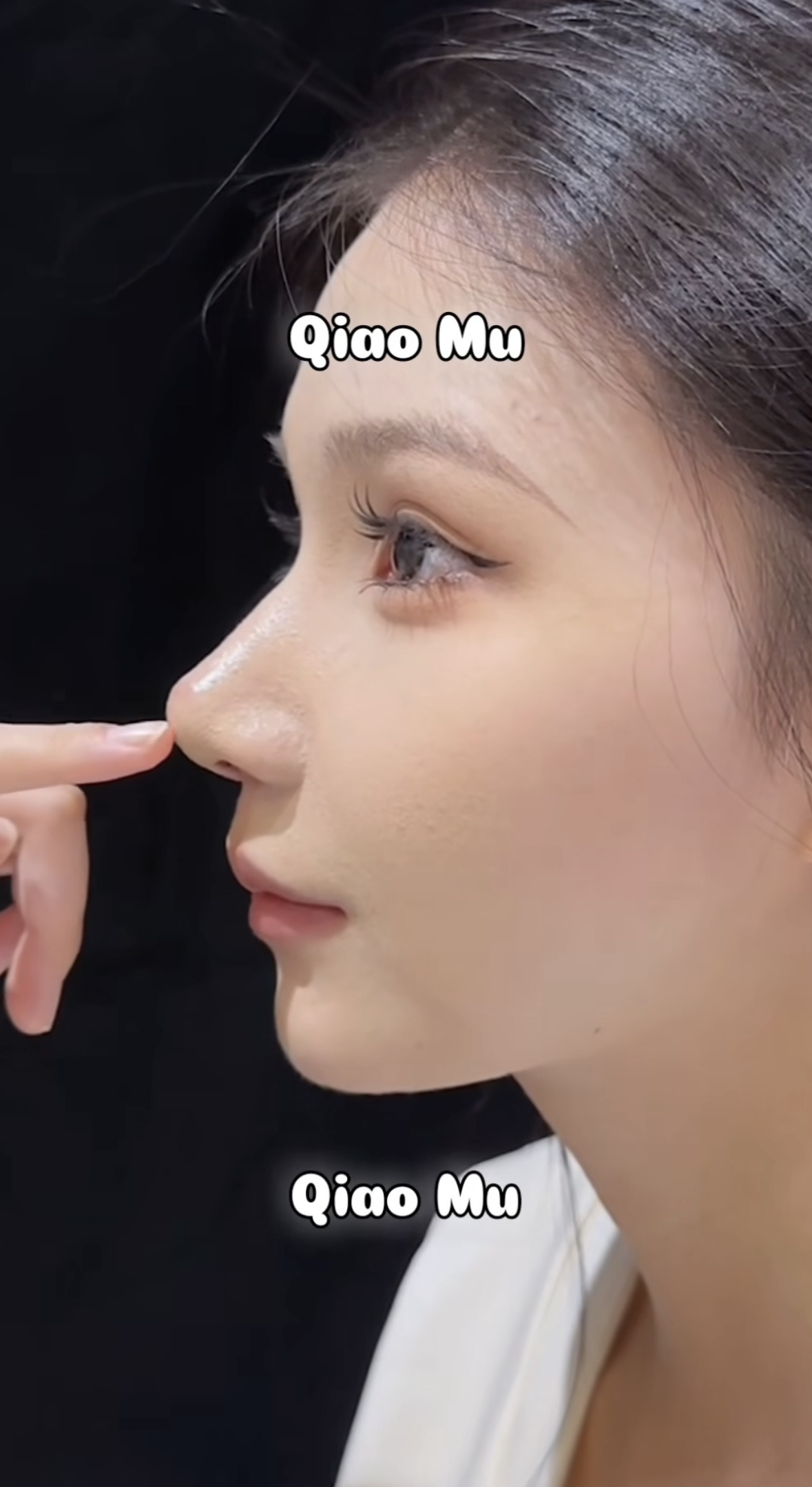 요즘 중국에서 유행이라는 코수술 모양.jpg | 인스티즈